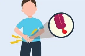 پیشگیری از آپاندیسیت