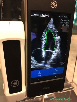 نرم افزار هوش مصنوعی DiA Imaging Analysis، که کار آن اندازه گیری خودکار کسر تخلیه‌ای قلب با استفاده از اکوکاردیوگرافی قلب است.