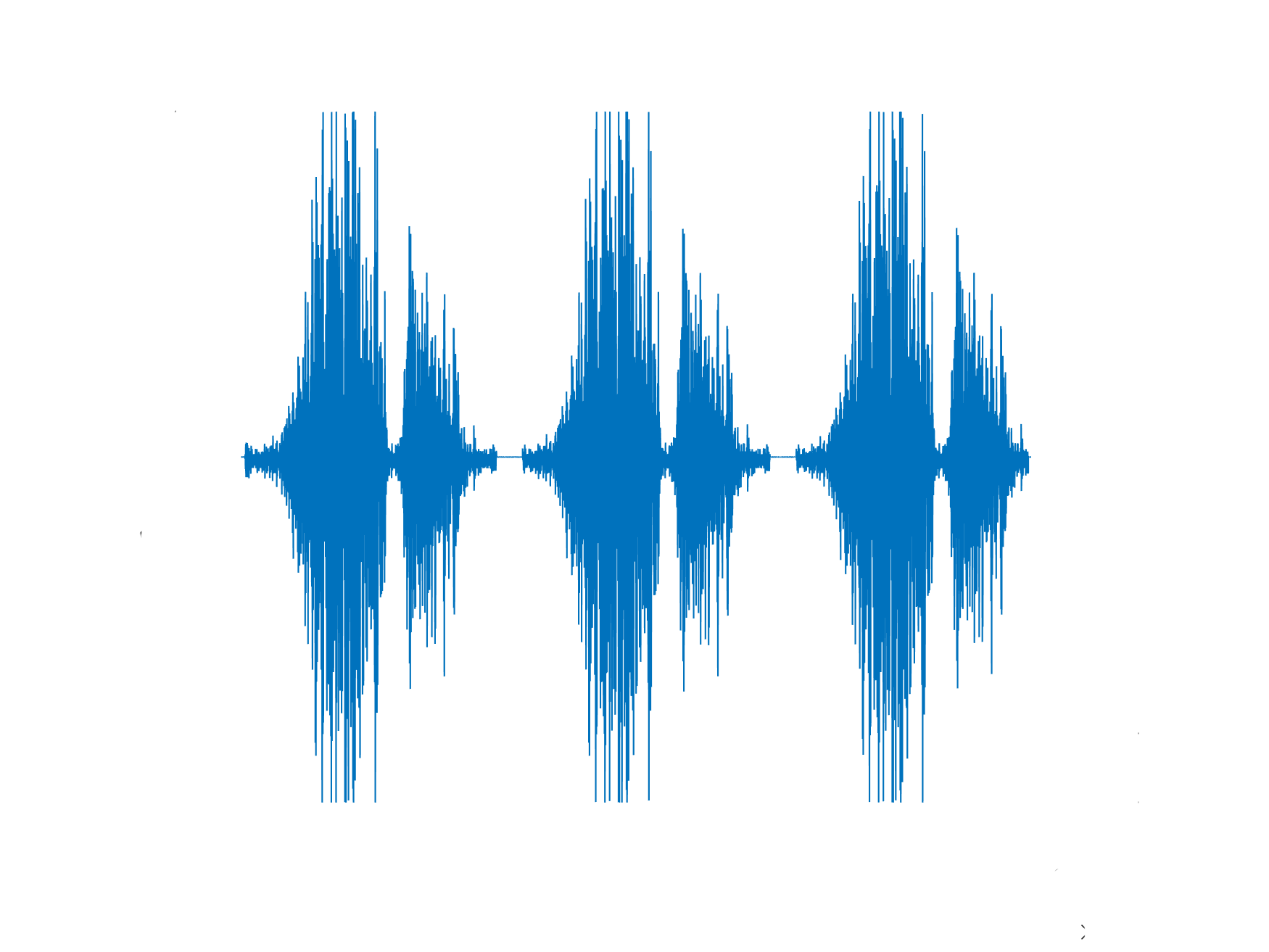 صداهای اضافی ریه - پلورال راب (Pleural Rubs)