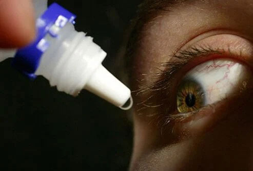 قطره چشم راهی برای درمان قرمزی چشم
